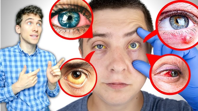 Did I Damage My Eyes With My Projector?